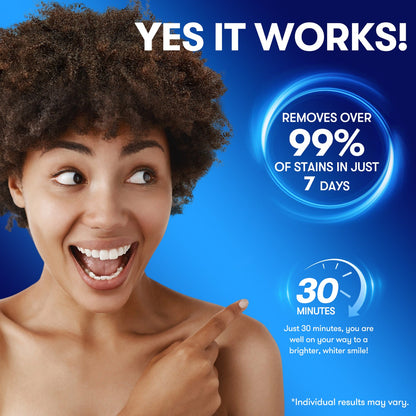 MySmile Teeth Whitening Strips with Natural Ingredients 14 Treatments (Allure)