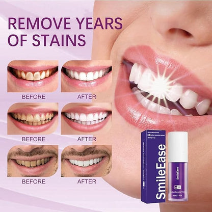 Purple Toothpaste for Teeth Whitening, Purple Whitening Toothpaste for Adults,Tooth Stain Remover Gel - Tooth Whitener Suitable for Smoking, Coffee, and Removing Dental Stone ﻿(2fl oz/60ml)
