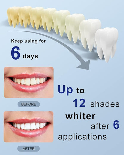 MySmile Teeth Whitening Strips Kit 14 Treatments with 28 LED Light - 10 Min Non-Sensitive Fast Whitening Teeth Enamel Safe Teeth Whitener - Helps to Remove Deep Stains