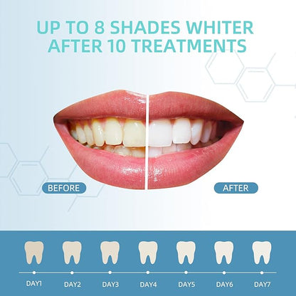 Teeth Whitening Gel Refills 10PCS Tooth Whitener 48+ Treatments -Removes Years of Stains 35% Carbamide Peroxide