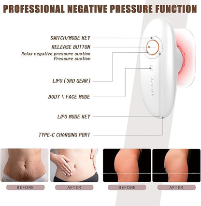 Thermoslim Body Sculpting Device - Triple-Action Sculpiflex Cellulite Device, Thermoslim Machine with Suction & Vibration for Thighs, Say Goodbye to Stubborn Cellulite