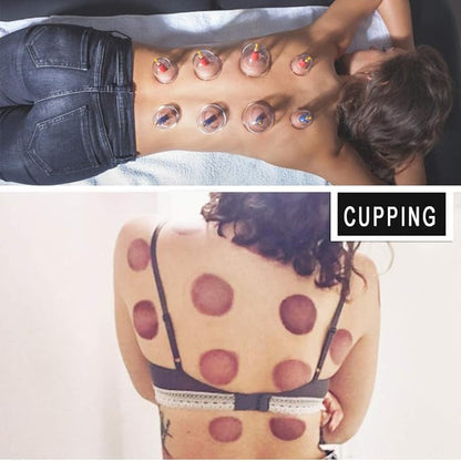 MUCHOO Cupping Set Professional Chinese Acupoint Cupping Therapy Sets Portable, Suction Hijama Cupping Set with Vacuum Magnetic Pump Cellulite Cupping Massage Kit 22-Cup