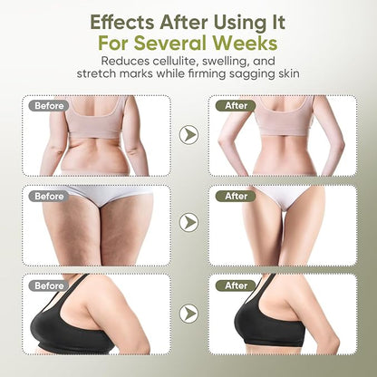 Lymphatic Drainage Massager & Anti Cellulite Massage Tool — Body Sculpting Machinefor Legs, Arms & Belly, Body,Helps Reduce Stretch Marks & Cellulite,with Microcurrent, Light Heat & Vibration