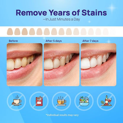 Whitebite Pro Upgraded Teeth Whitening Strips 28 Strips (14 Treatments) | Enamel-Safe | Deep Stains Removal | Non-Slip Design | Whitening Without Any Harm | Mint