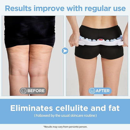 Cellulite Massage Tool Deep Fascia Massager & Dimpled Skin Remover for Legs - Anti-Cellulite Roller Tech with Lymphatic Drainage, Smooth Skin & Pain Relief for Thighs & Buttocks Sculpting