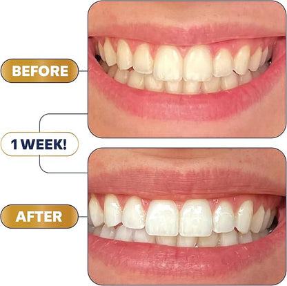 Lumineux Teeth Whitening Strips 9 Treatments – Peroxide Free - Enamel Safe for Whiter Teeth - Whitening Without The Sensitivity - Dentist Formulated - Sensitivity Free