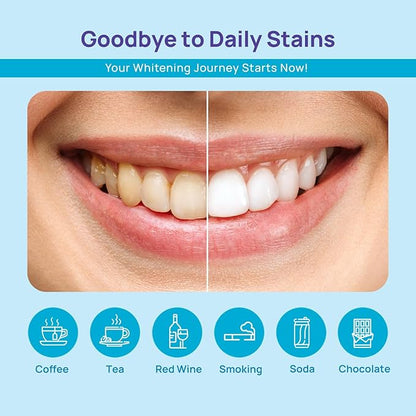 WhiteBite Pro Teeth Whitening Pens for Sensitive Teeth – 4 Pens Total (1 Blue Gel Pen for Sensitivity Relief), 35% Carbamide Peroxide Gel, Fast Whitening Results, Enamel-Safe, Travel-Friendly