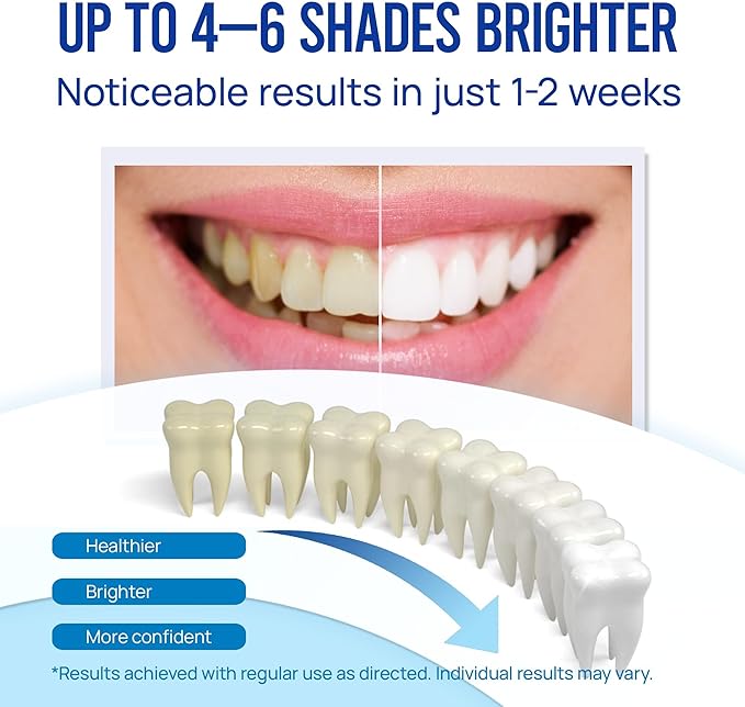 Teeth Whitening Pen Gel Kit: 35% Carbamide Peroxide Gel for Stain Removal - No Sensitivity with Remineralizing Pen for a Brighter Whiter Smile Mint