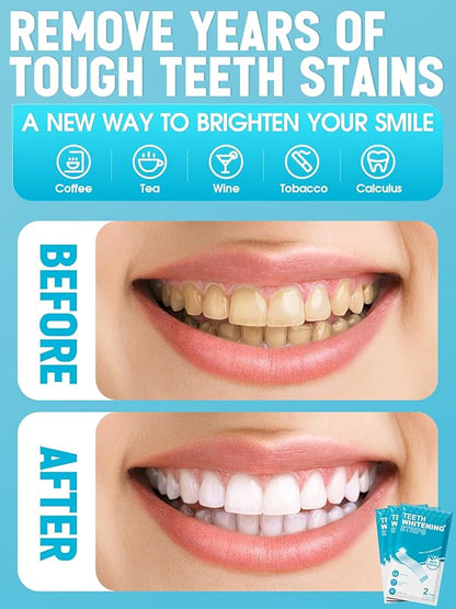 Oralfree Natural Teeth Whitening Strips - Sensitive Teeth Whitener - Enamel Safe Teeth Whitening Kit with Hydrogen Peroxide for Coffee, Wine, Tobacco, and Other Stains, 28 Strips (14 Treatment), Mint