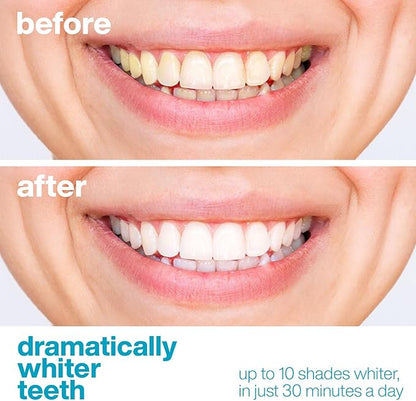 AquaSonic Professional Teeth Whitening Strips - Enamel Safe Teeth Whitening with Hydrogen Peroxide - Easy to Use, Non-Slip, Affordable & Effective (Unflavored)