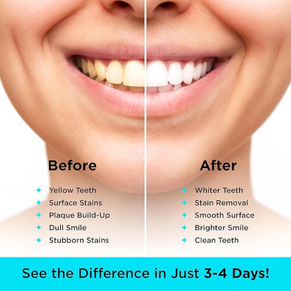 CARBON WHITE Teeth Whitening Powder - Natural Activated Coconut Charcoal Tooth Powder for Removing Stains & Discoloration - Helps Fight Tartar & Plaque, Freshens Breath - Tasteless, Odorless - 30g