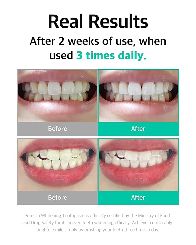 Live Orals Whitening Toothpaste 80g x 3Units - Fluoride-Free Stain Removal, Strengthens Enamel, Natural Ingredients, Fresh Mint Flavor