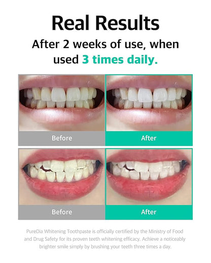 Live Orals Whitening Toothpaste 80g x 3Units - Fluoride-Free Stain Removal, Strengthens Enamel, Natural Ingredients, Fresh Mint Flavor