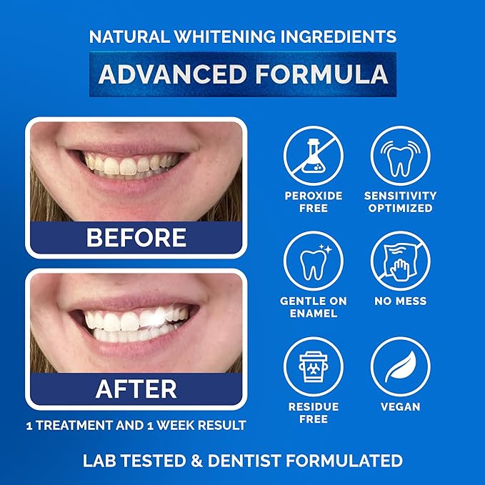 Whitening Strips for Sensitive Teeth 14 Treatments, Mint – Enamel Safe, Peroxide-Free Coconut Teeth Whitening Strips with Natural Enzymes – Gentle White Stips for Sensitive Gums & Daily Oral Care