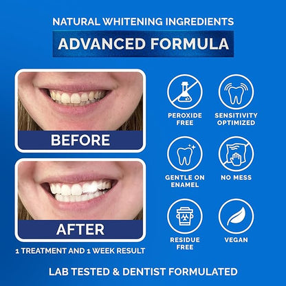 Whitening Strips for Sensitive Teeth 21 Treatments, Mint – Enamel Safe, Peroxide-Free Coconut Teeth Whitening Strips with Natural Enzymes – Gentle White Stips for Sensitive Gums & Daily Oral Care