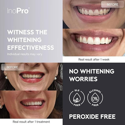 Natural Teeth Whitening Strips Kit 21 Treatments - Sensitive Teeth Whitener, Peroxide Free, Enamel Safe White Strips - Instant Teeth Whitening Without The Harm (42 Strips)