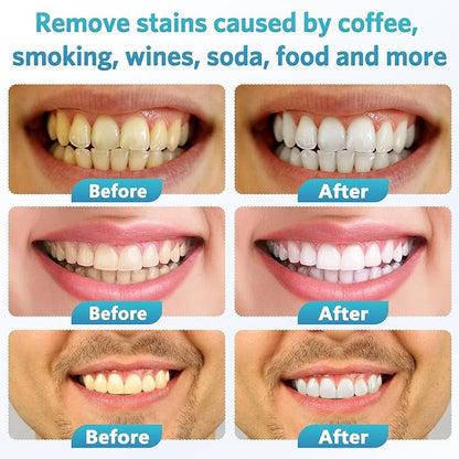 BESTEK Teeth Whitening Kit - 32X LED Teeth Whitening Light, 10 Min Fast Teeth Whitener with 4 Tubes of 35% Carbamide Peroxide Teeth Whitening Gel for Remove Coffee Wine Tobacco Teeth Stains - Blue