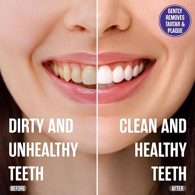 SprinJene Fluoride Free Toothpaste for Sensitive Teeth & Gum Fresh Breath Helps Dry Mouth Natural Non Fluoride Toothpaste for Adult SLS Free, Toxic Preservative Free with Black Seed Oil & Zinc 1 Pack