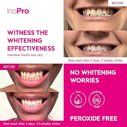 Teeth Whitening Strips 21 Treatments Kit - Teeth Whitener, Peroxide Free, Enamel Safe Green Whitestrips, Deep Stains Removal - Instant Teeth Whitening Without The Harm (42 Strips)