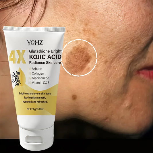 Crema facial con ácido kójico, unifica el tono de la piel, elimina las manchas oscuras y la opacidad - No grasosa, apta para hombres y mujeres - Crema blanqueadora e hidratante, para uso diurno y nocturno