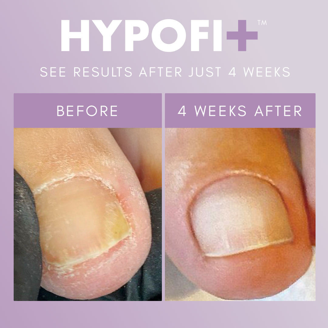 The GelBottle - HypoFix 2-Step System